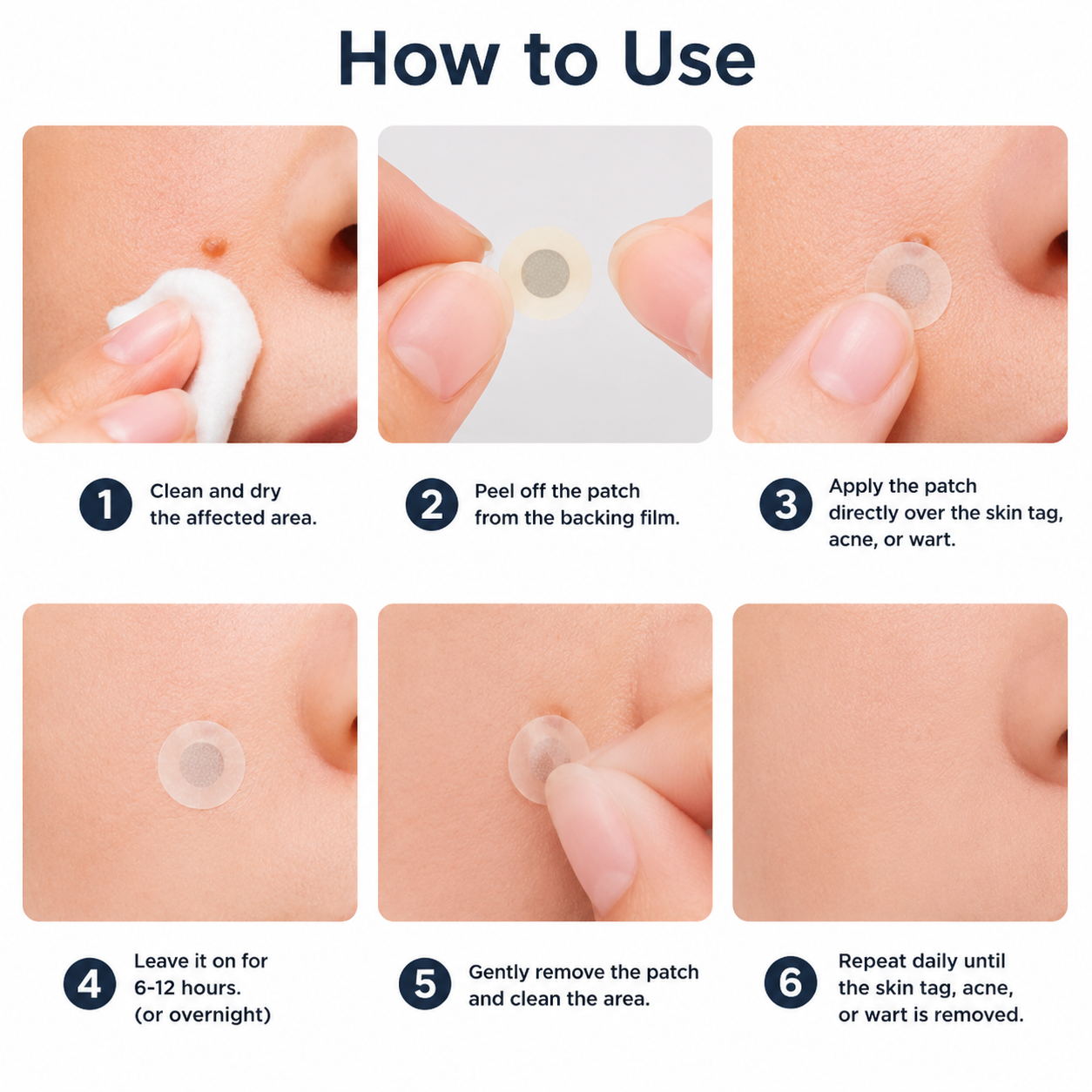 Mightyvra® Microneedle Clear Patches ✨Targets Skin Tags, Acne, Wrinkles & Blemishes