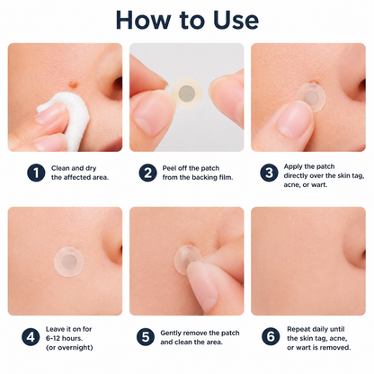 Mightyvra® Microneedle Clear Patches ✨Targets Skin Tags, Acne, Wrinkles & Blemishes