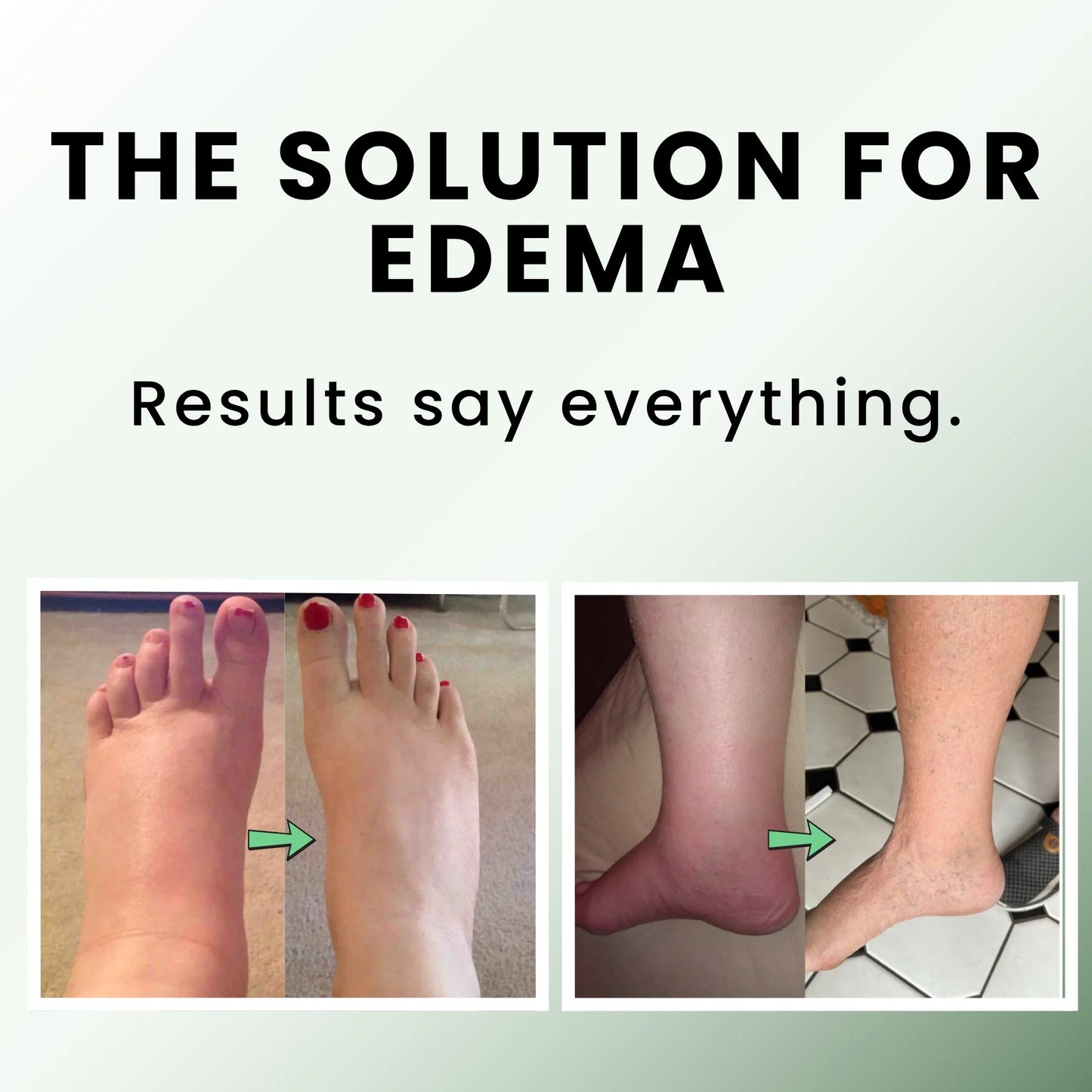 Taileden Miracle Balm-2.0