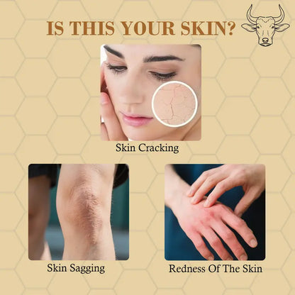 CHEEMEX Grass-Fed Beef Tallow Honey Balm