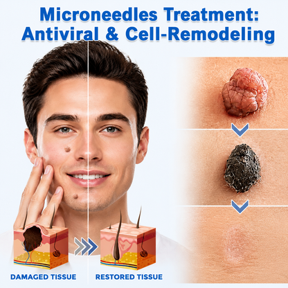Mightyvra® Microneedle Clear Patches ✨Targets Skin Tags, Acne, Wrinkles & Blemishes