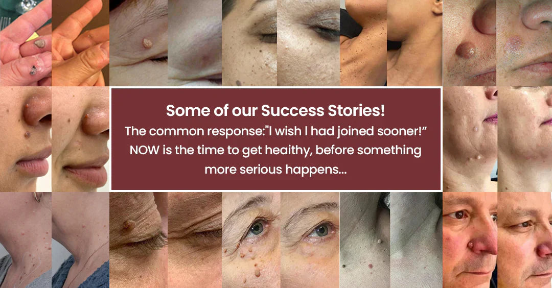 Mightyvra® Microneedle Clear Patches ✨Targets Skin Tags, Acne, Wrinkles & Blemishes